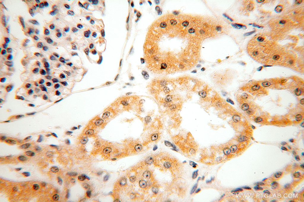 HEXB Polyclonal antibody