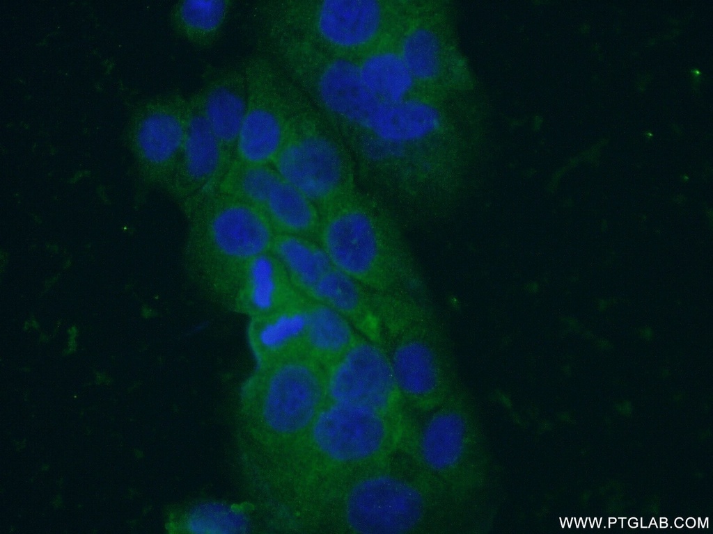 VIP Polyclonal antibody