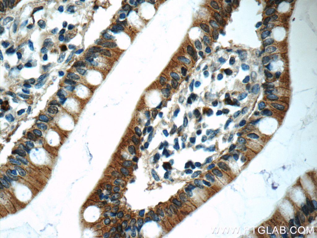 Carboxypeptidase A3 Polyclonal antibody