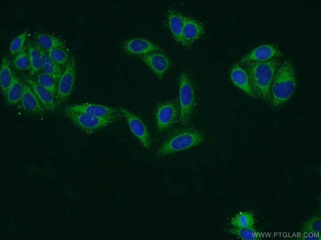 ATP13A1 Polyclonal antibody