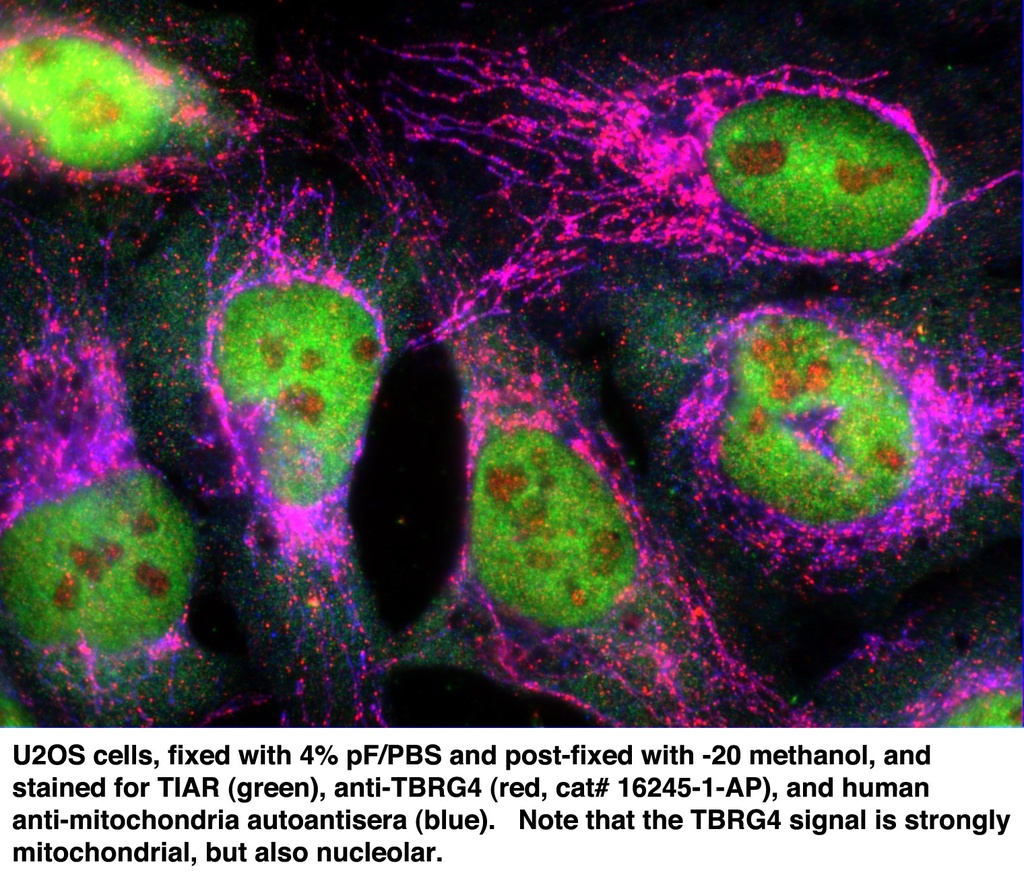 TBRG4 Polyclonal antibody