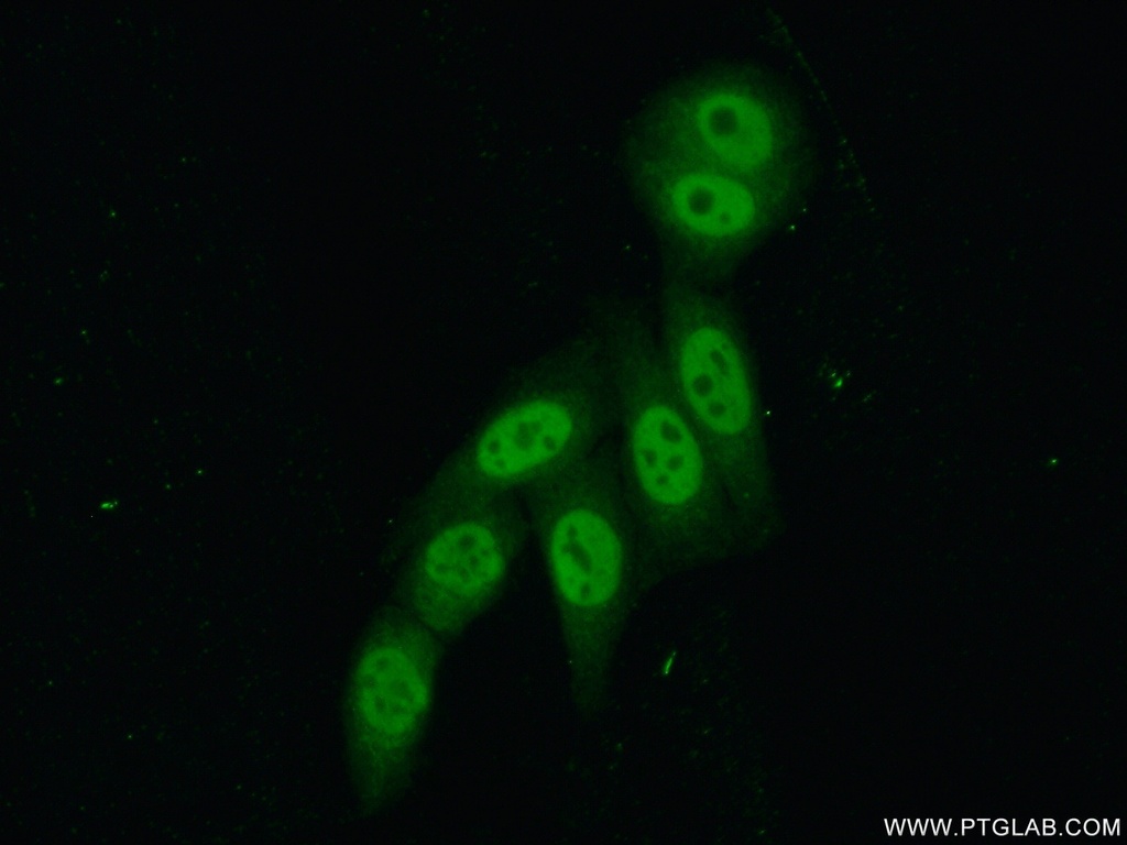 PSF2 Polyclonal antibody