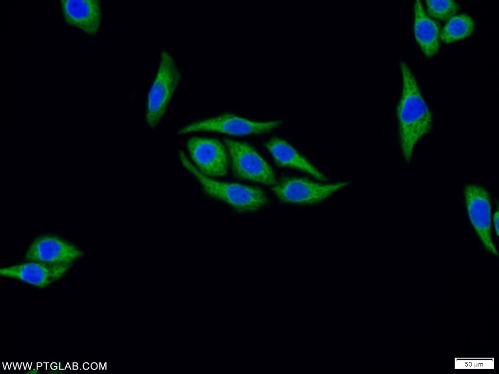 FAF2 Polyclonal antibody