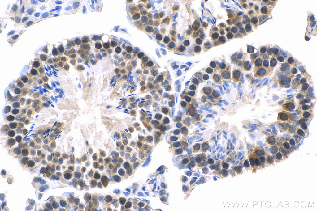 MED28 Polyclonal antibody