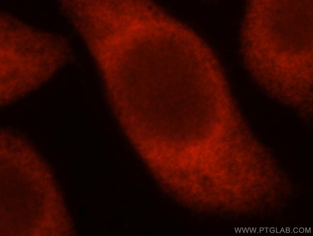 TSR2 Polyclonal antibody