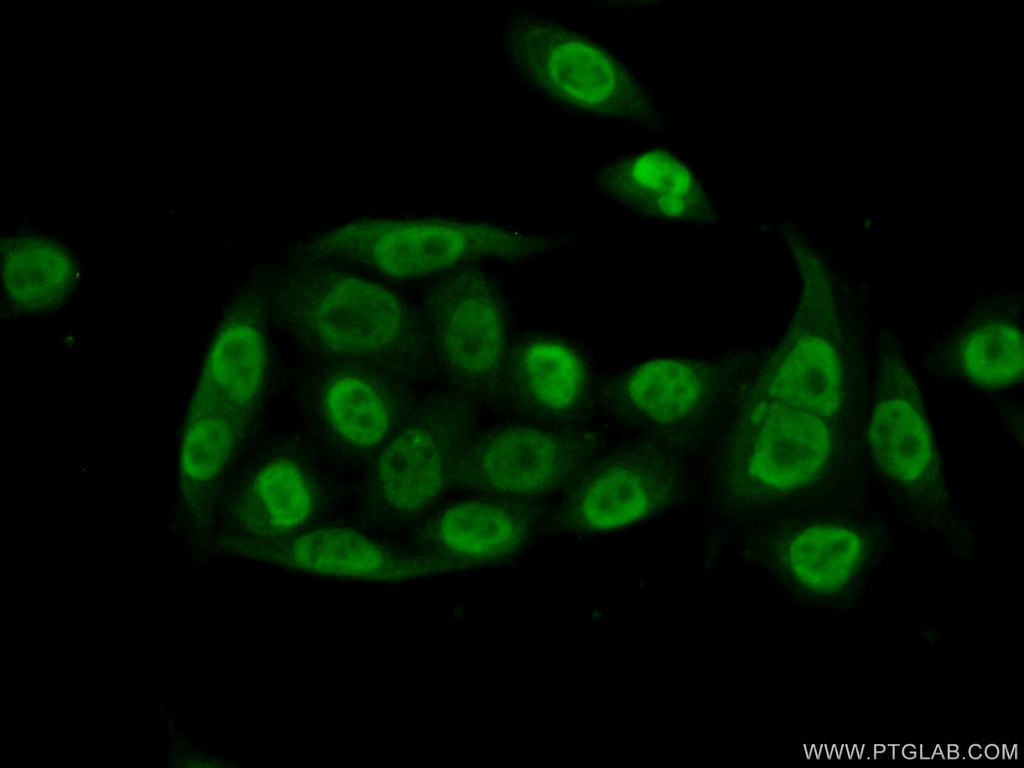 PQBP1 Polyclonal antibody