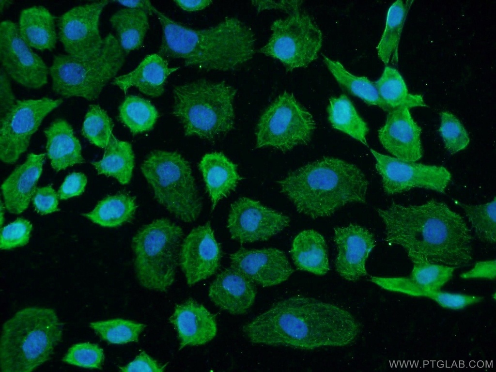 GCC1 Polyclonal antibody