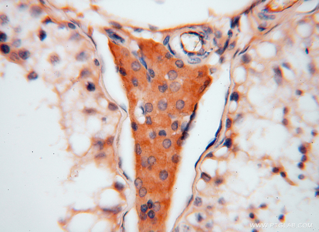 ATP6V1C2 Polyclonal antibody