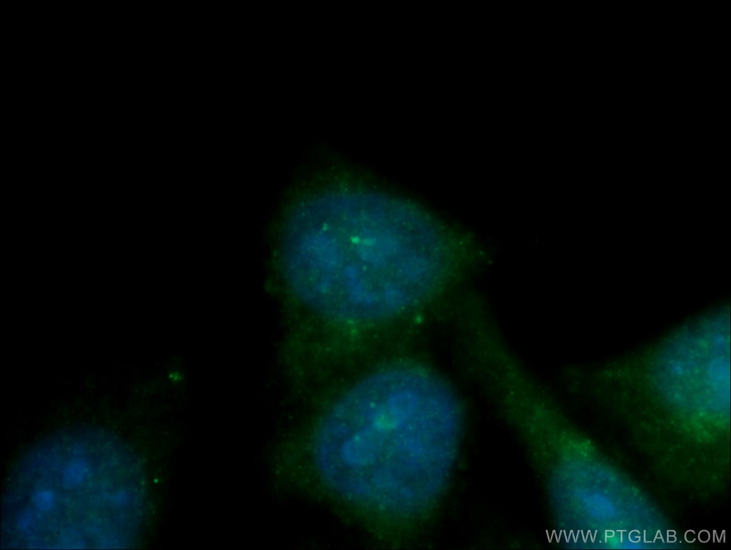 CEP70 Polyclonal antibody