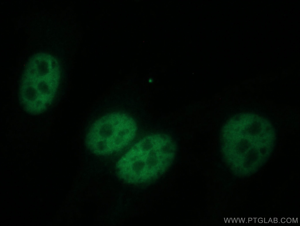 DPY30 Polyclonal antibody