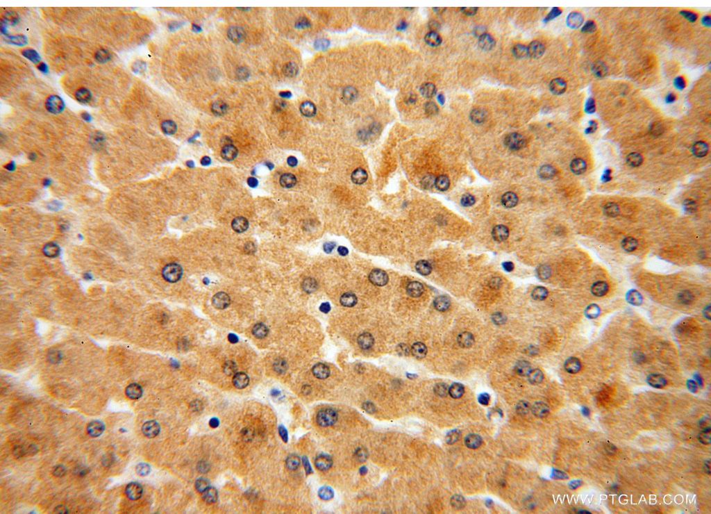 GNPNAT1 Polyclonal antibody