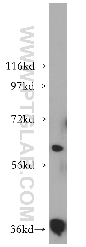 RDH14 Polyclonal antibody