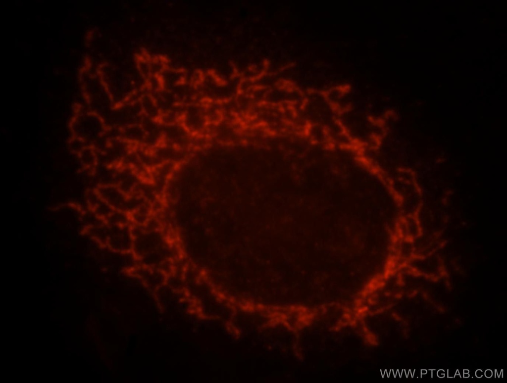 MRPS31 Polyclonal antibody
