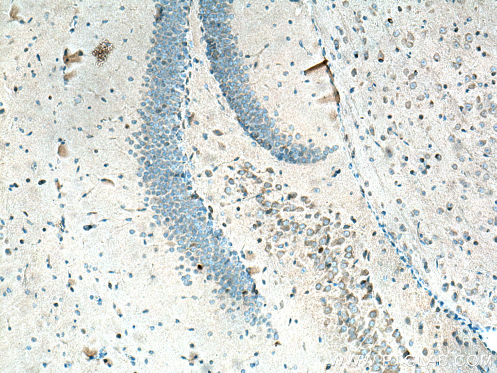 ARC/ARG3.1 Polyclonal antibody