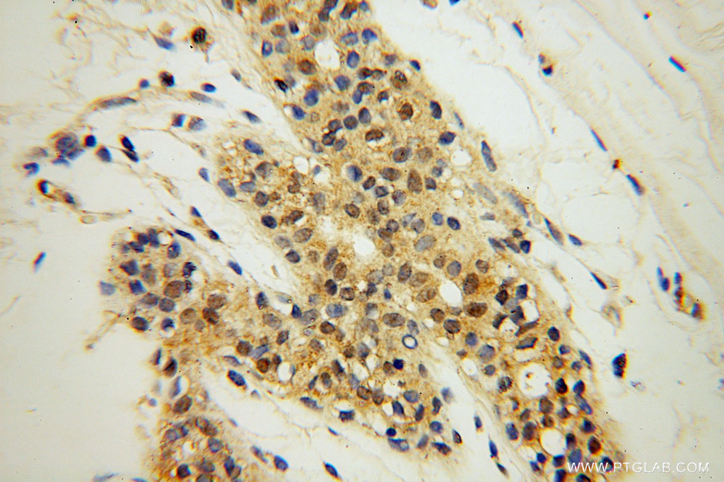 SPAG7 Polyclonal antibody