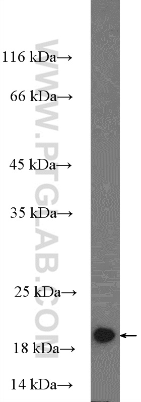 MRPL22 Polyclonal antibody