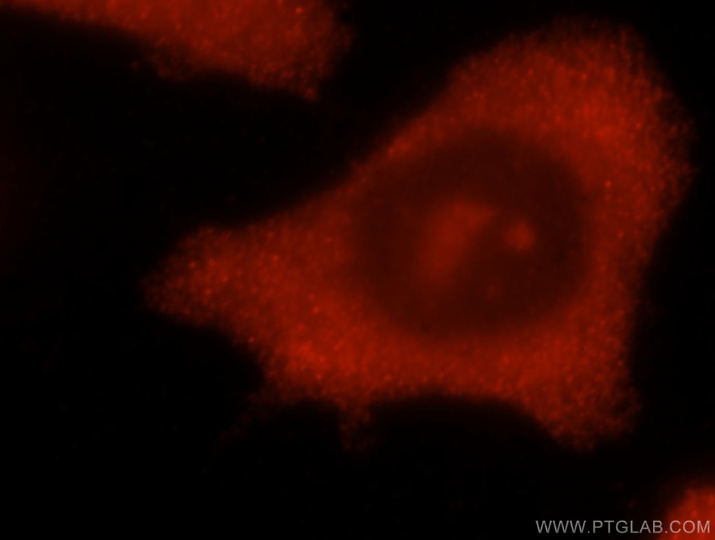 CHAC2 Polyclonal antibody