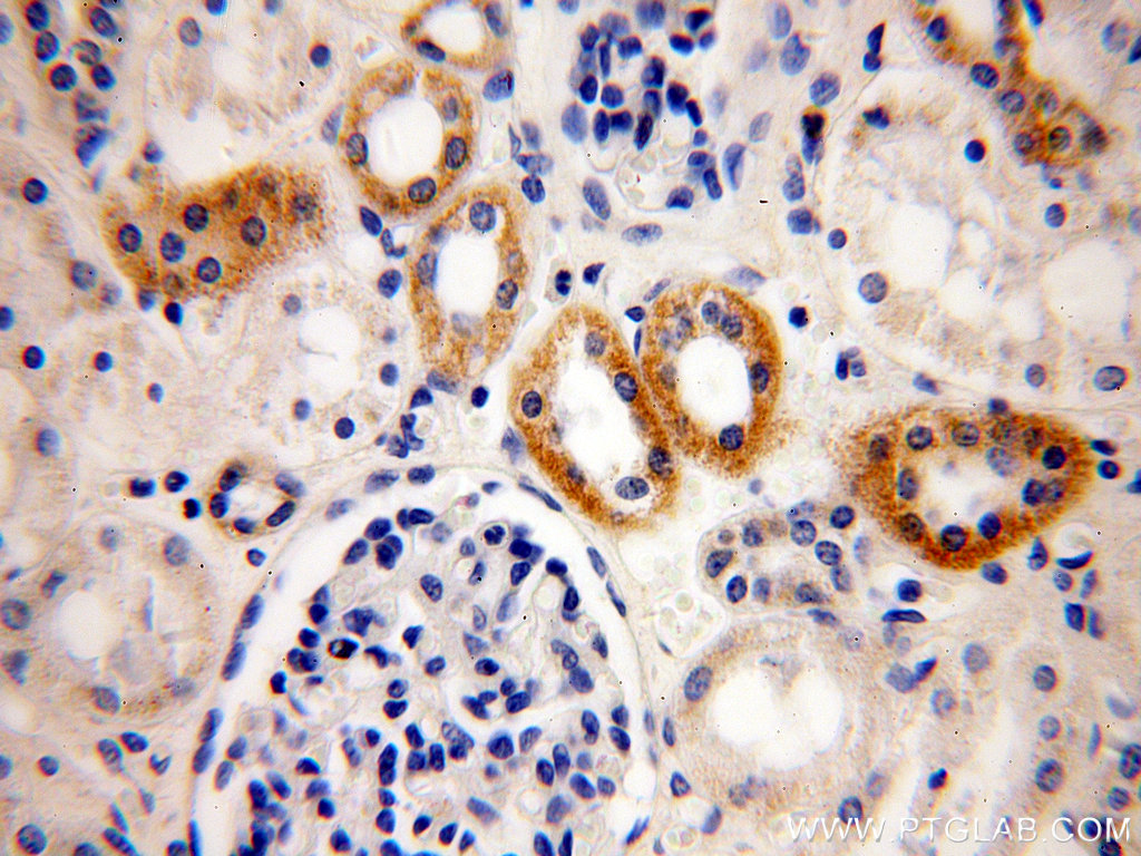 ATP5L Polyclonal antibody