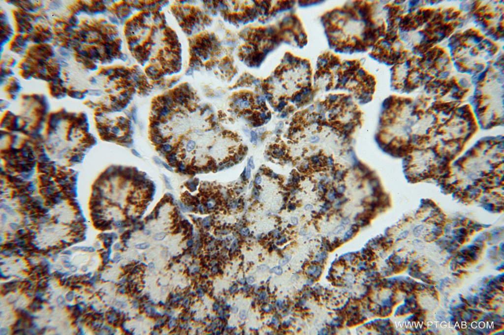 GCAT Polyclonal antibody