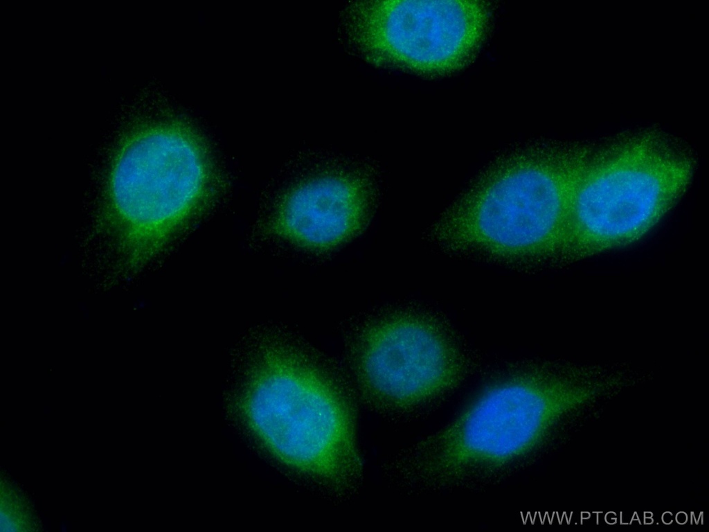UAP1 Polyclonal antibody
