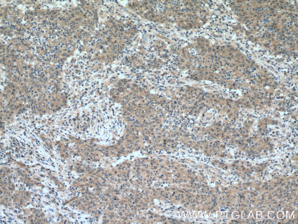 BACE2 Polyclonal antibody