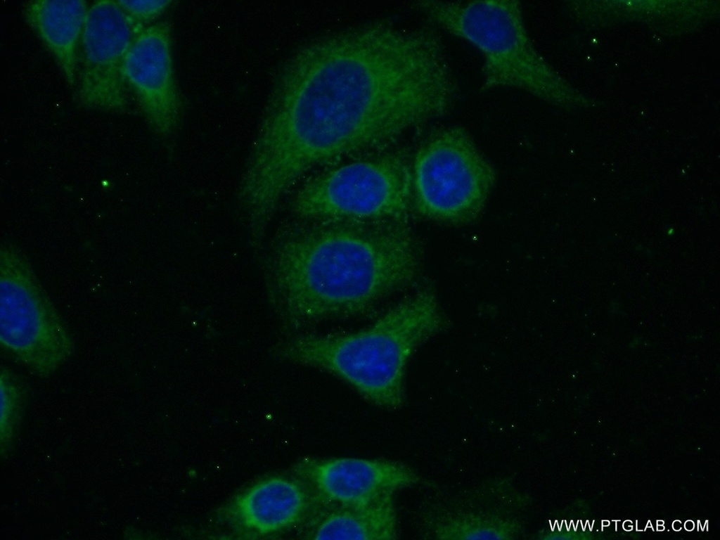 BTD Polyclonal antibody