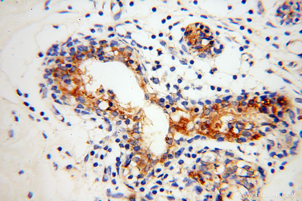 GUSB Polyclonal antibody