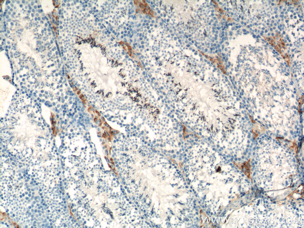 SLC35A1 Polyclonal antibody