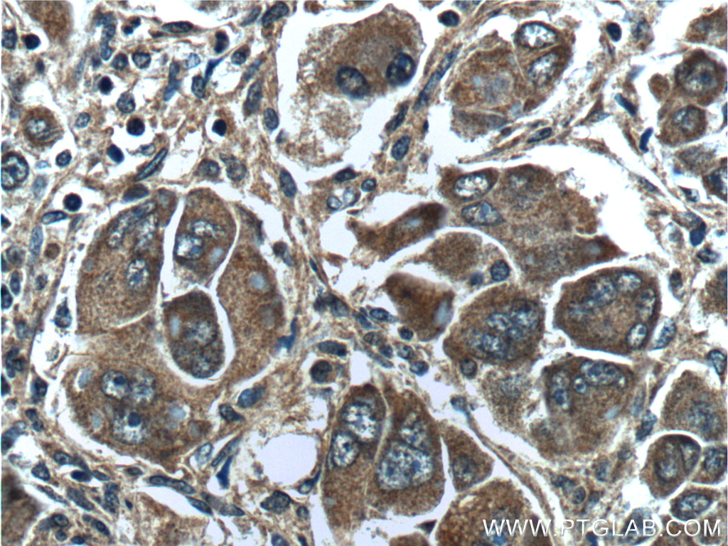 PAH Polyclonal antibody