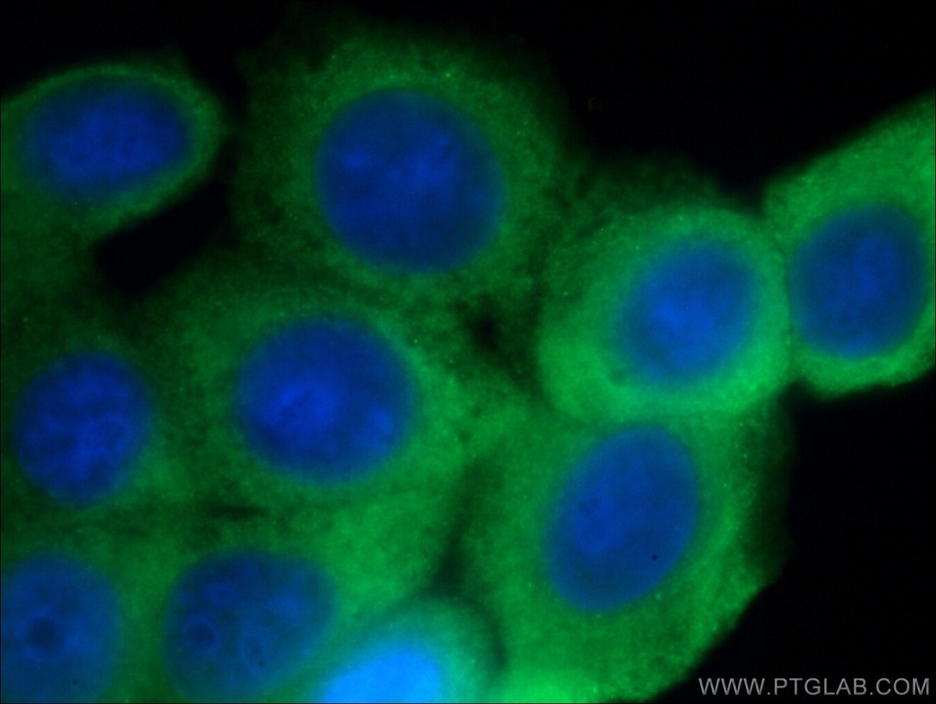 GTPBP9 Polyclonal antibody