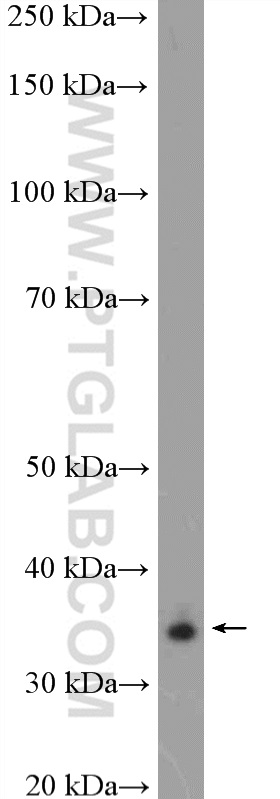 ALX1 Polyclonal antibody