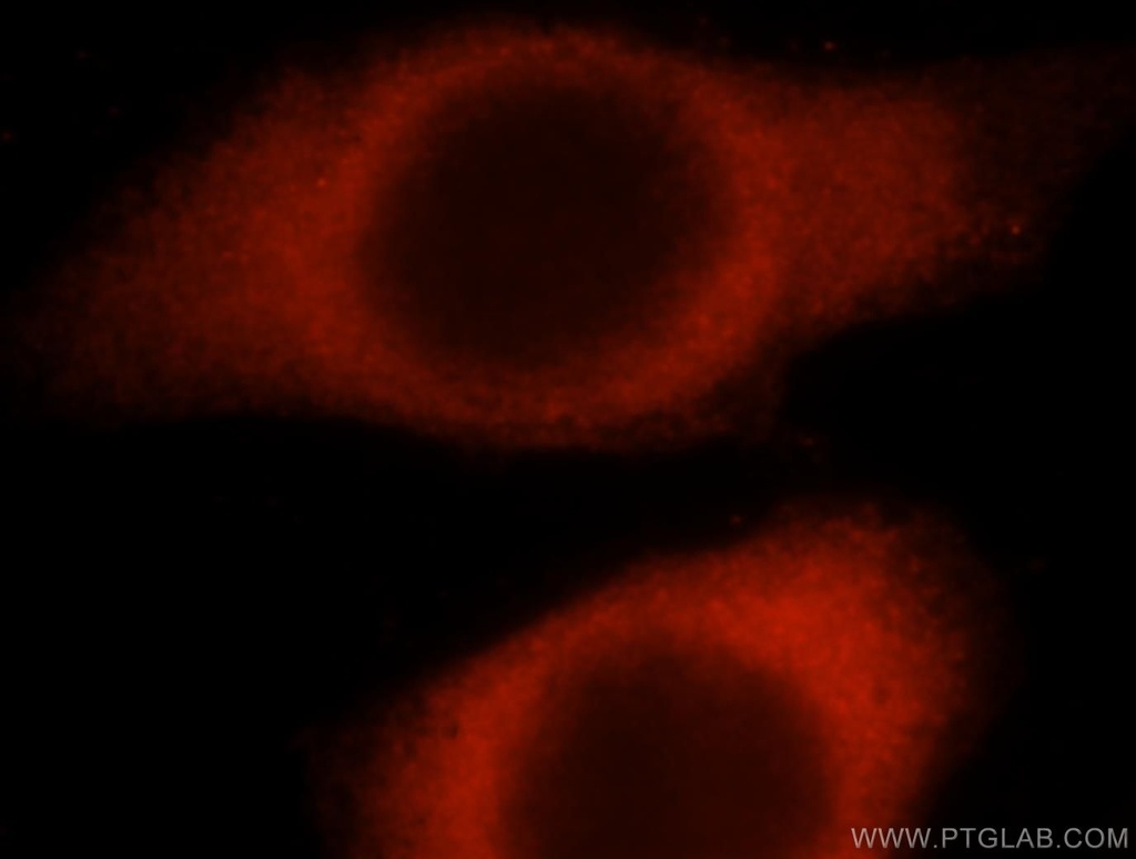 HARS Polyclonal antibody