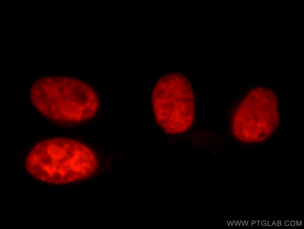 XRCC5/Ku80 Polyclonal antibody