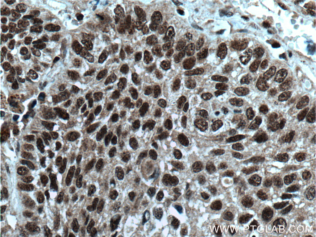 BANP Polyclonal antibody