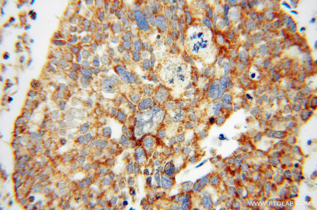 MRPL44 Polyclonal antibody