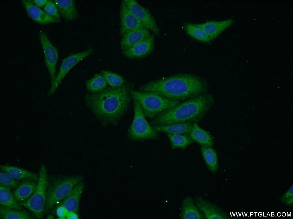 Biglycan Polyclonal antibody