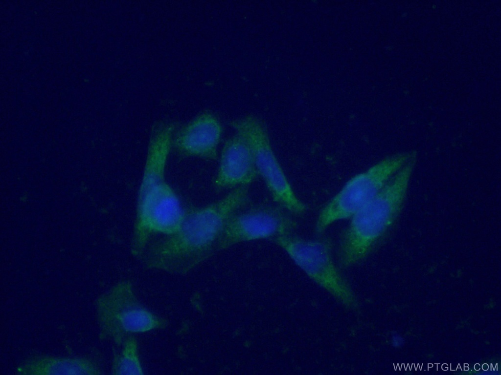 ENO3 Polyclonal antibody