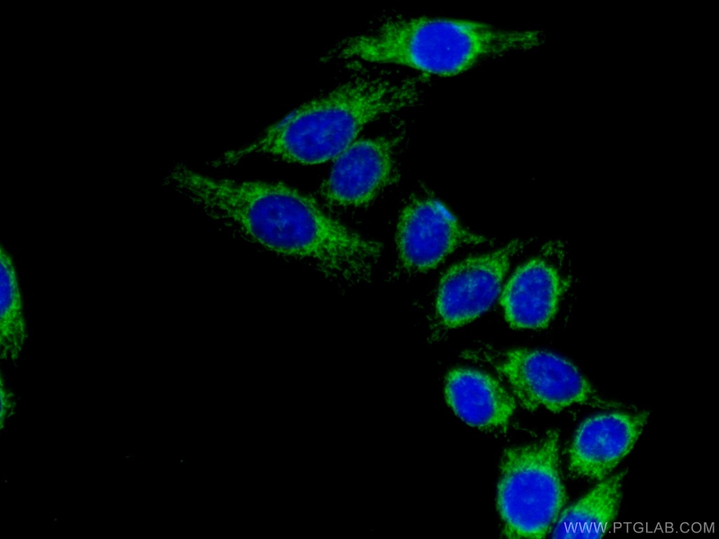 DLD Polyclonal antibody