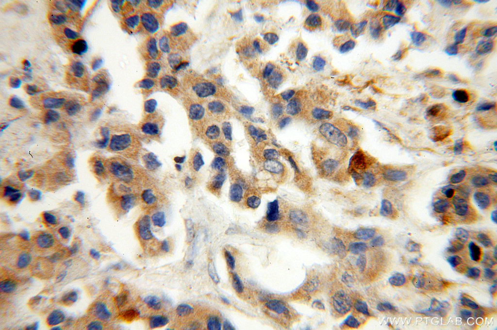 ST6GALNAC5 Polyclonal antibody