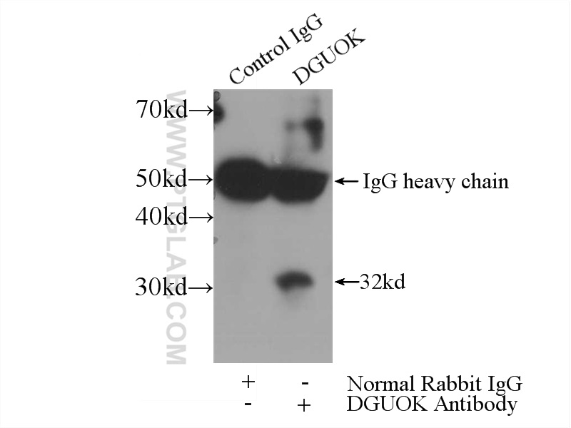 dGK Polyclonal antibody