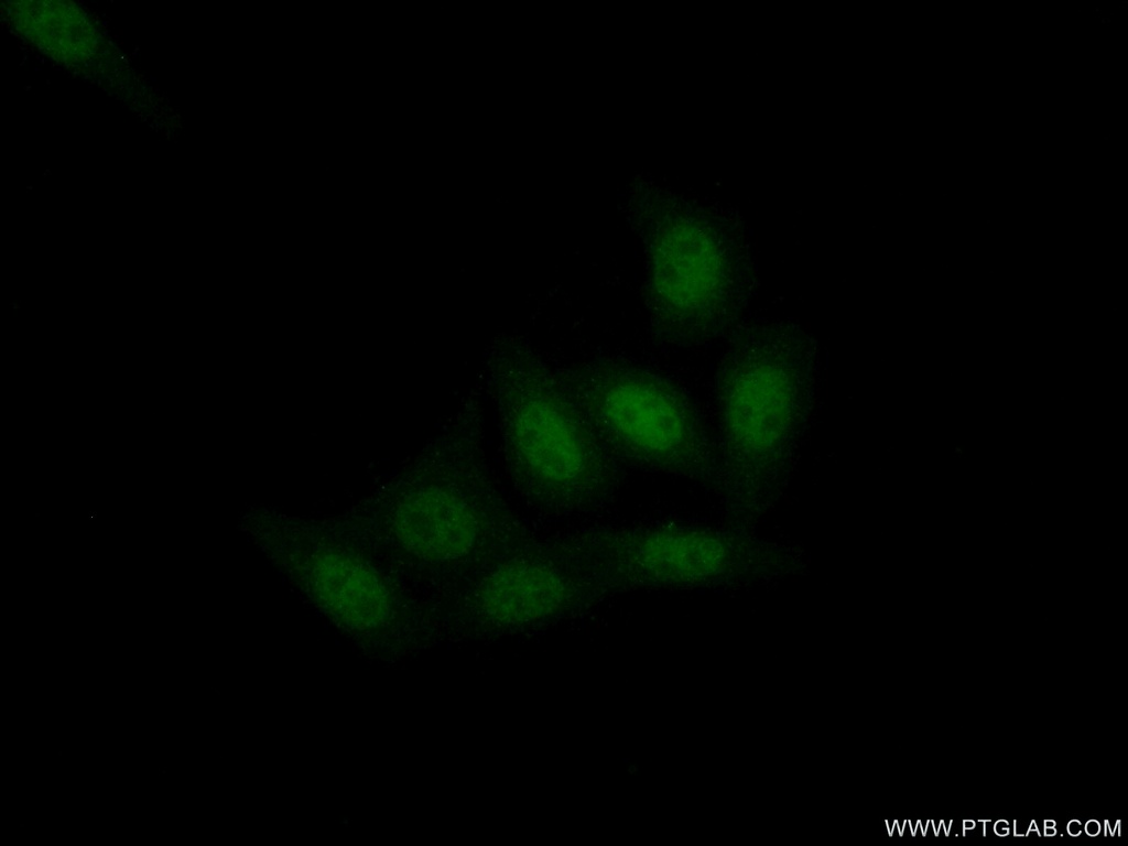 XPA Polyclonal antibody