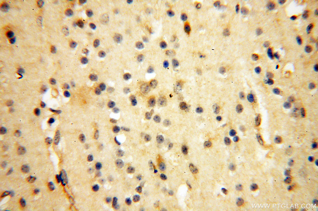 PCSK5 Polyclonal antibody
