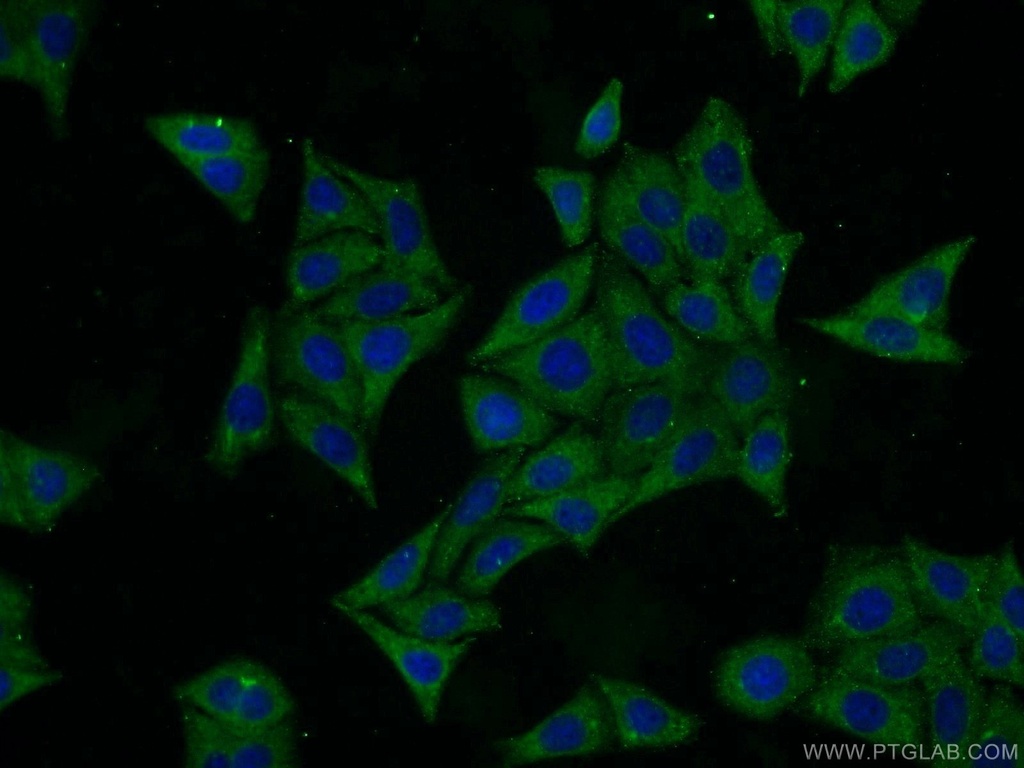 SRI Polyclonal antibody