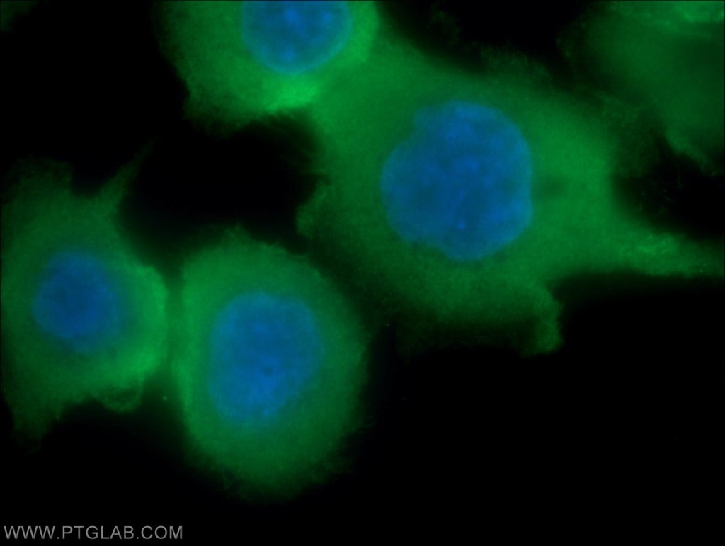 Villin Polyclonal antibody