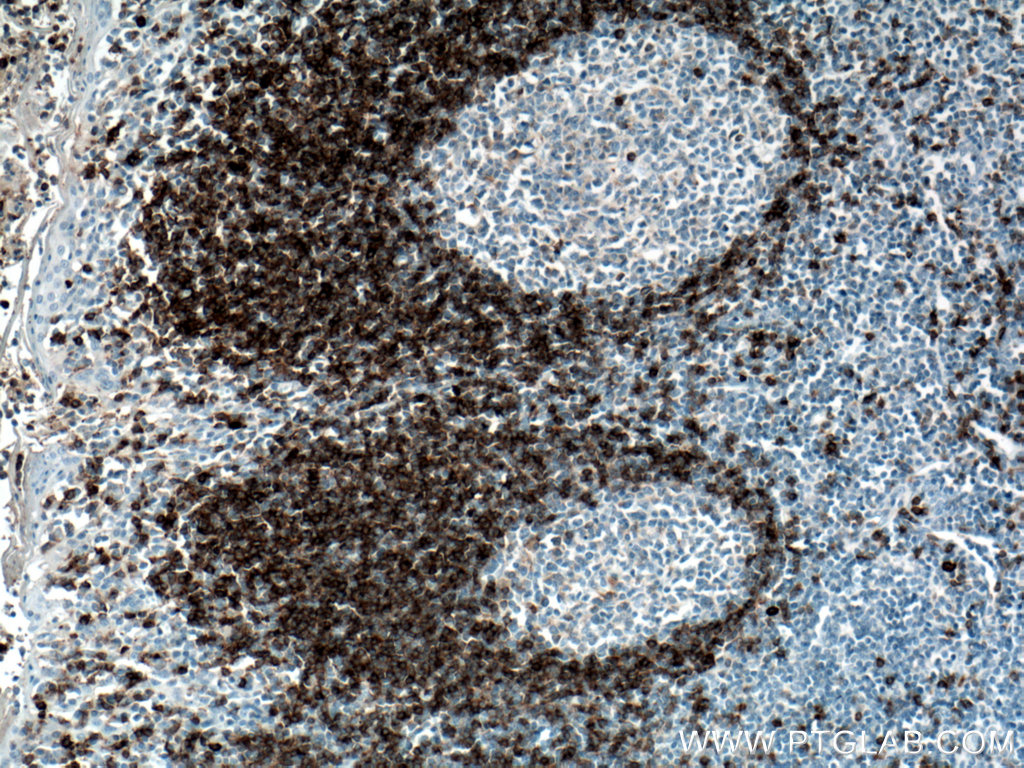 IGHD Polyclonal antibody