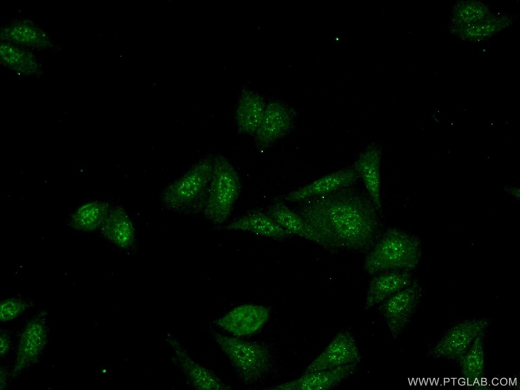 SDCCAG10 Polyclonal antibody