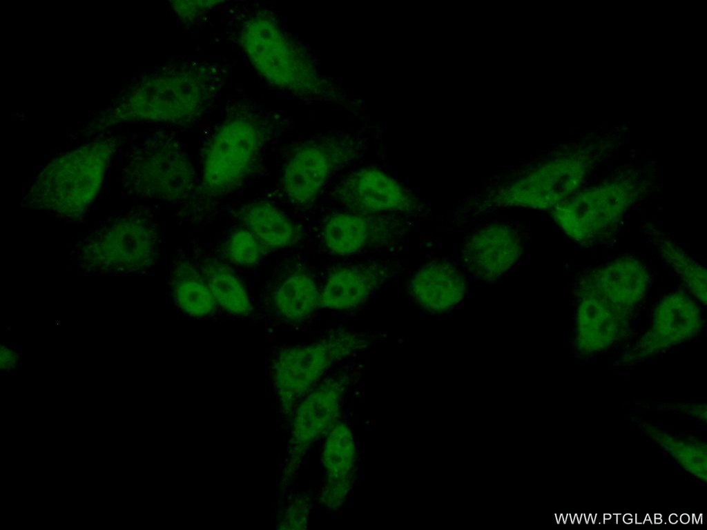 SUPT5H Polyclonal antibody