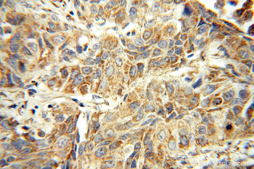 DUSP22 Polyclonal antibody