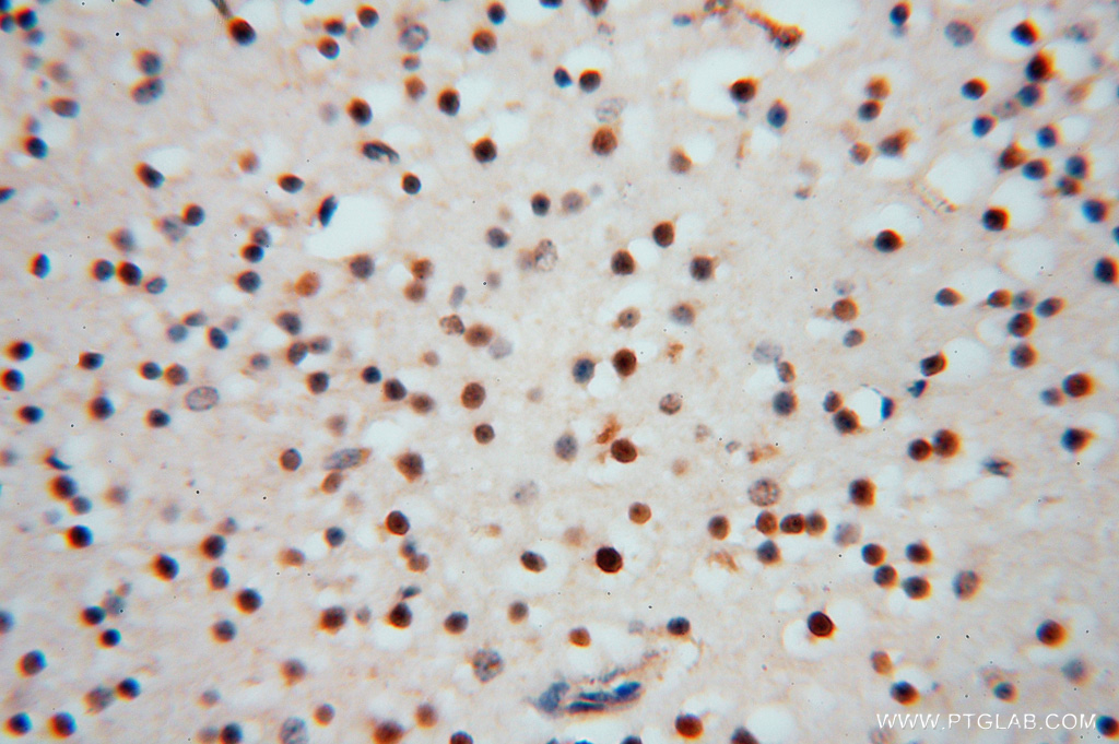 RNASEH2C Polyclonal antibody