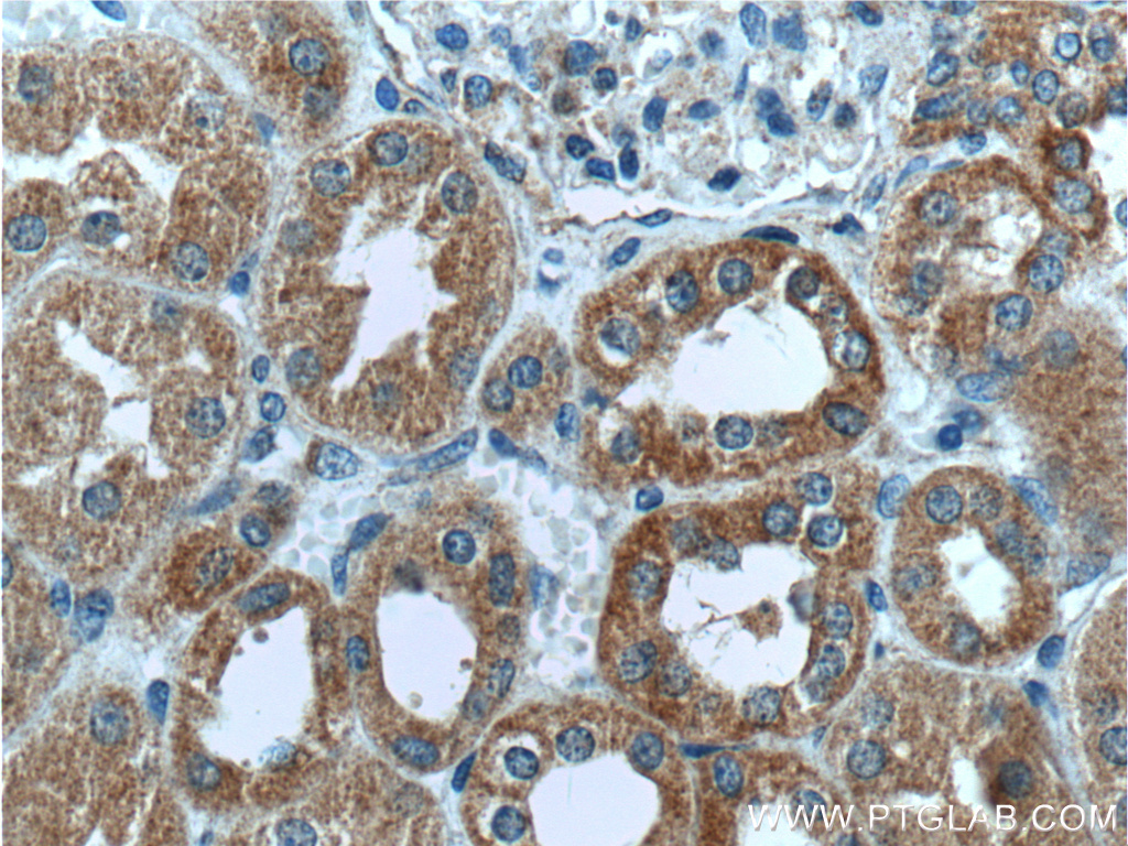 MRPS9 Polyclonal antibody
